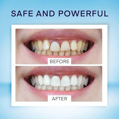 2‑Pack Teeth Whitening Pen – Jumbo Size Stain Remover Pen (Delicate)