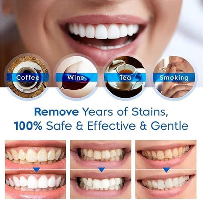 2‑Pack Teeth Whitening Pen – Jumbo Size Stain Remover Pen (Delicate)